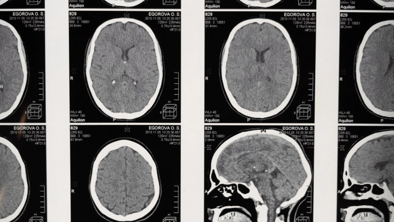 Curso de Técnicas de Neuroimagen